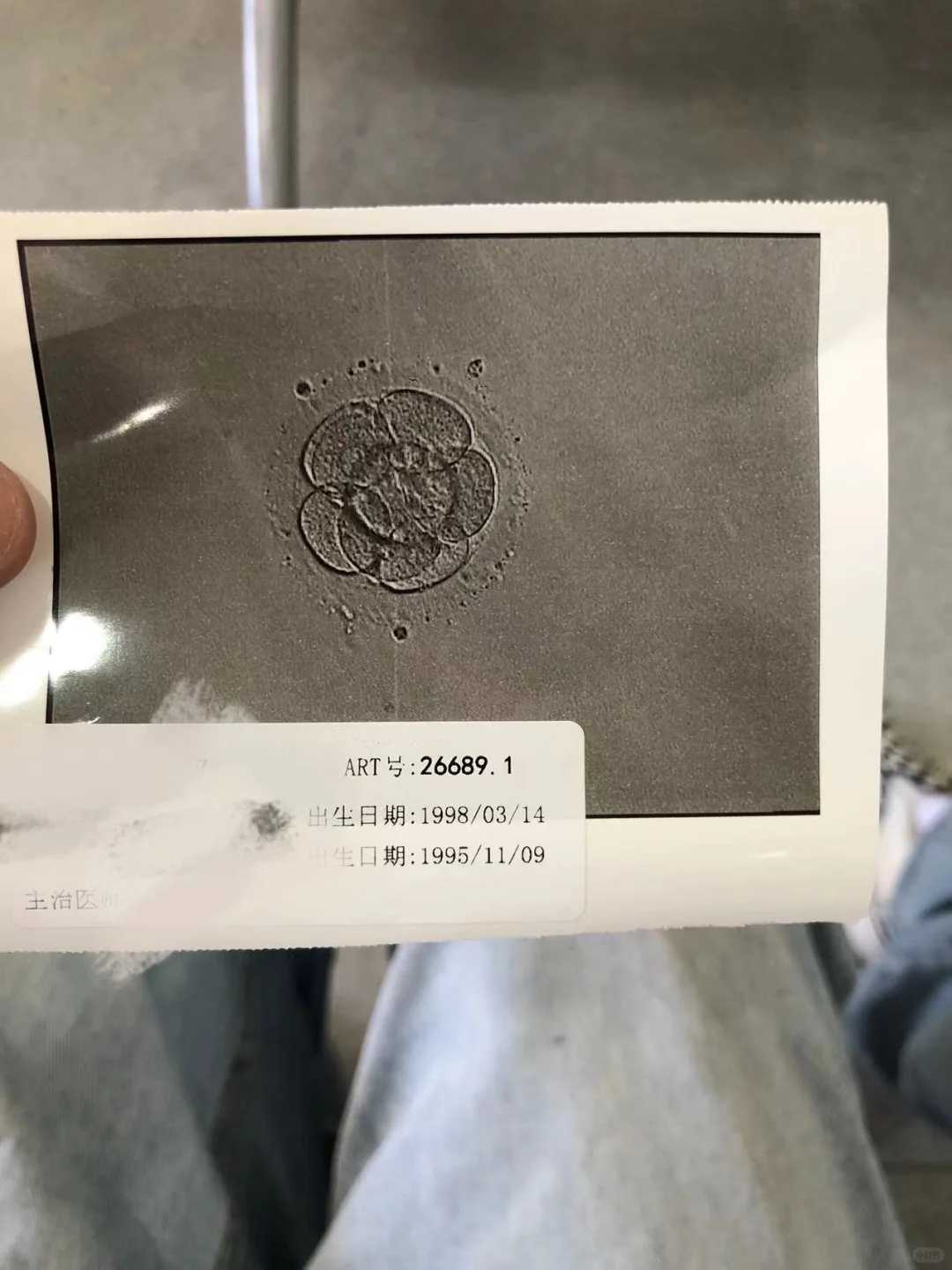 成都大龄怎样借卵,2024成都试管医院借卵代怀试管费用？附费用明细？