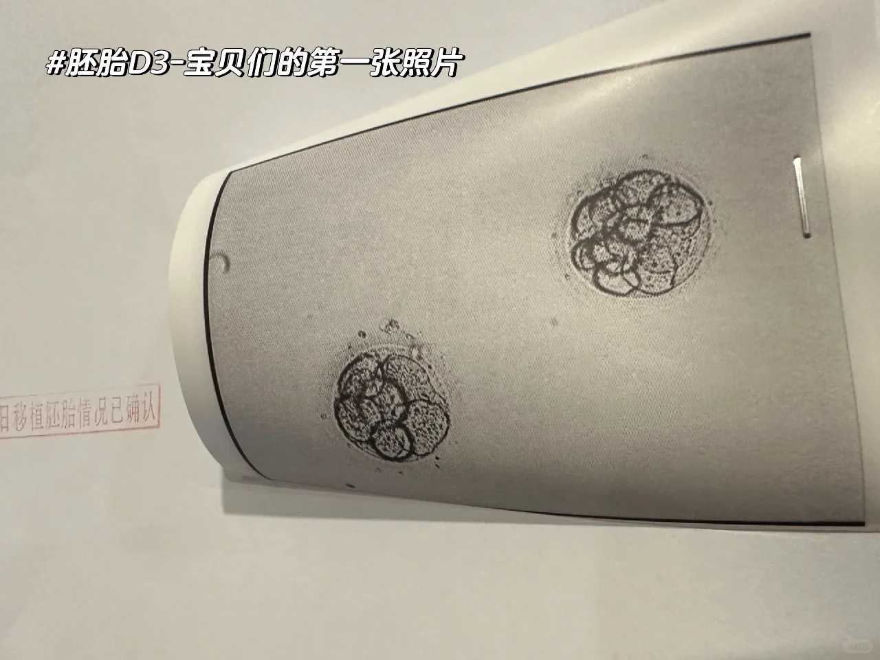 精因宝贝生殖中心价格[供卵试管平台],北大深圳医院三代试管婴儿包生男孩费用