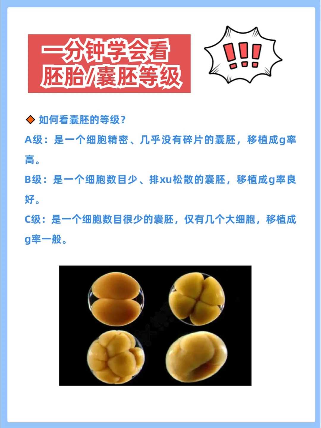 怎么查看自己是否怀孕（常用的几种怀孕检测方法）