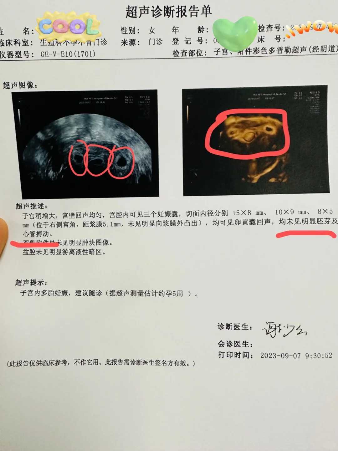 成都代孕价格代孕产子的产生及权益,成都试管医院,成都试管婴儿医院